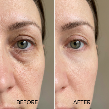 Youthful Radiance Red Light Wand™ 4-in-1 Skin Rejuvenation Tool